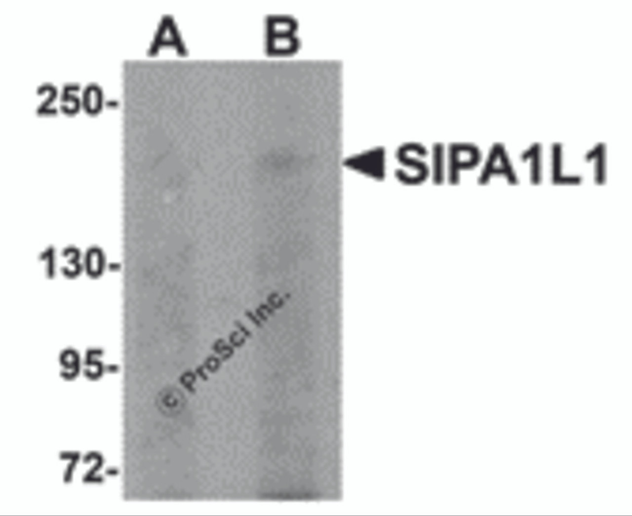 Western blot analysis of SIPA1L1 in rat brain tissue lysate with SIPA1L1 antibody at (A) 0.5 and (B) 1 &#956;g/mL.