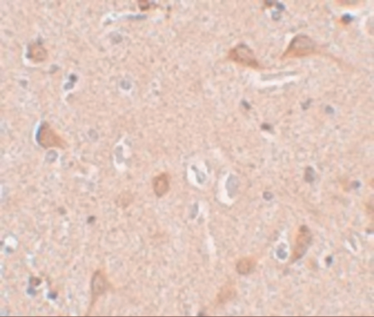 Immunohistochemistry of SIPA1L1 in human brain tissue with SIPA1L1 antibody at 5 ug/mL.