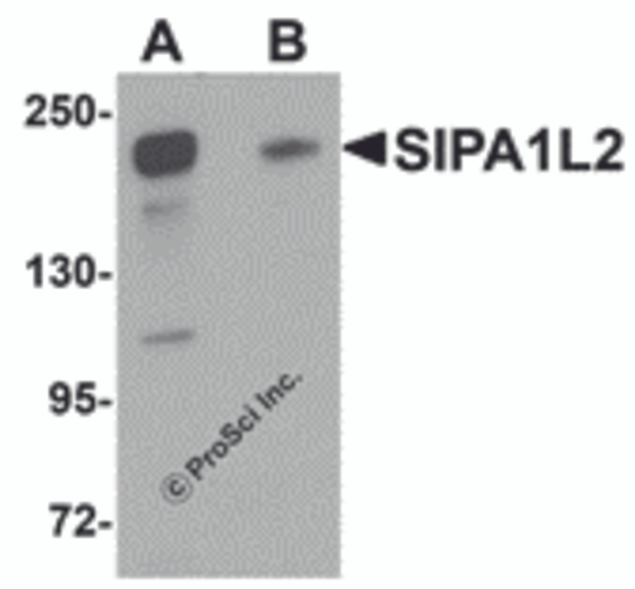 Western blot analysis of SIPA1L2 in rat brain tissue lysate with SIPA1L2 antibody at 1 &#956;g/mL in (A) the absence and (B) the presence of blocking peptide.
