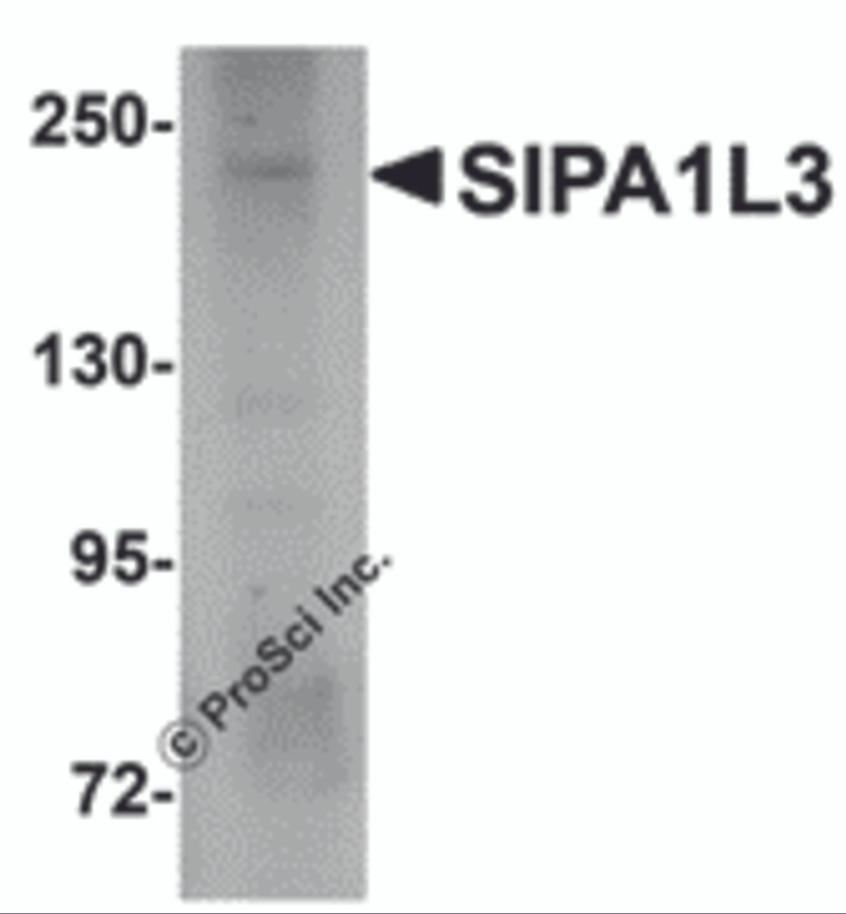 Western blot analysis of SIPA1L3 in SK-N-SH lysate with SIPA1L3 antibody at 1 &#956;g/mL.