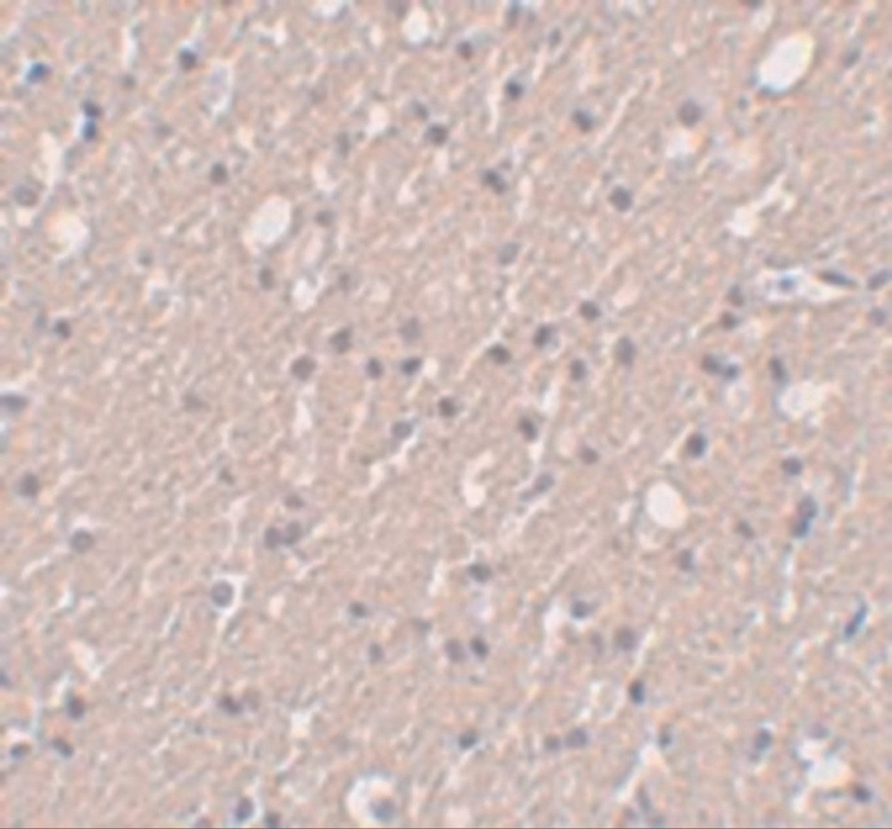 Immunohistochemistry of SIPA1L3 in human brain tissue with SIPA1L3 antibody at 5 ug/mL.