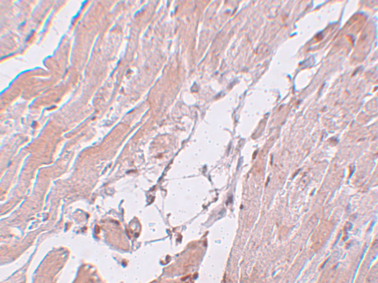 Immunohistochemistry of CCDC47 in mouse heart tissue with CCDC47 antibody at 5 ug/mL.