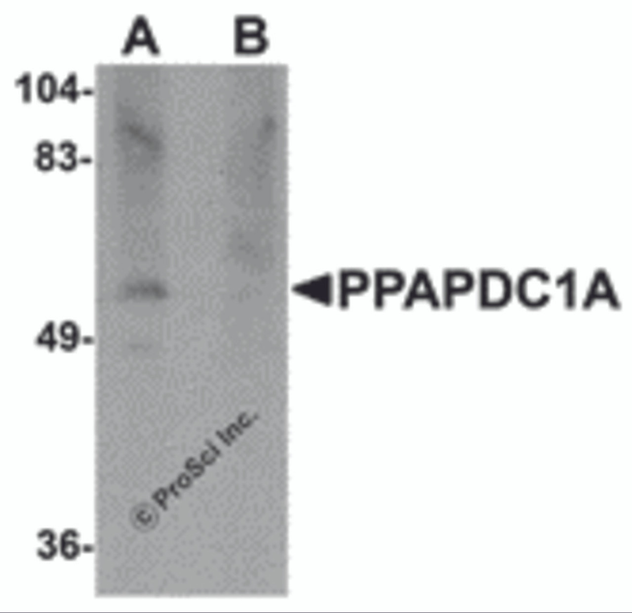 Western blot analysis of PPAPDC1A in human brain tissue lysate with PPAPDC1A antibody at 1 &#956;g/mL in (A) the absence and (B) the presence of blocking peptide.