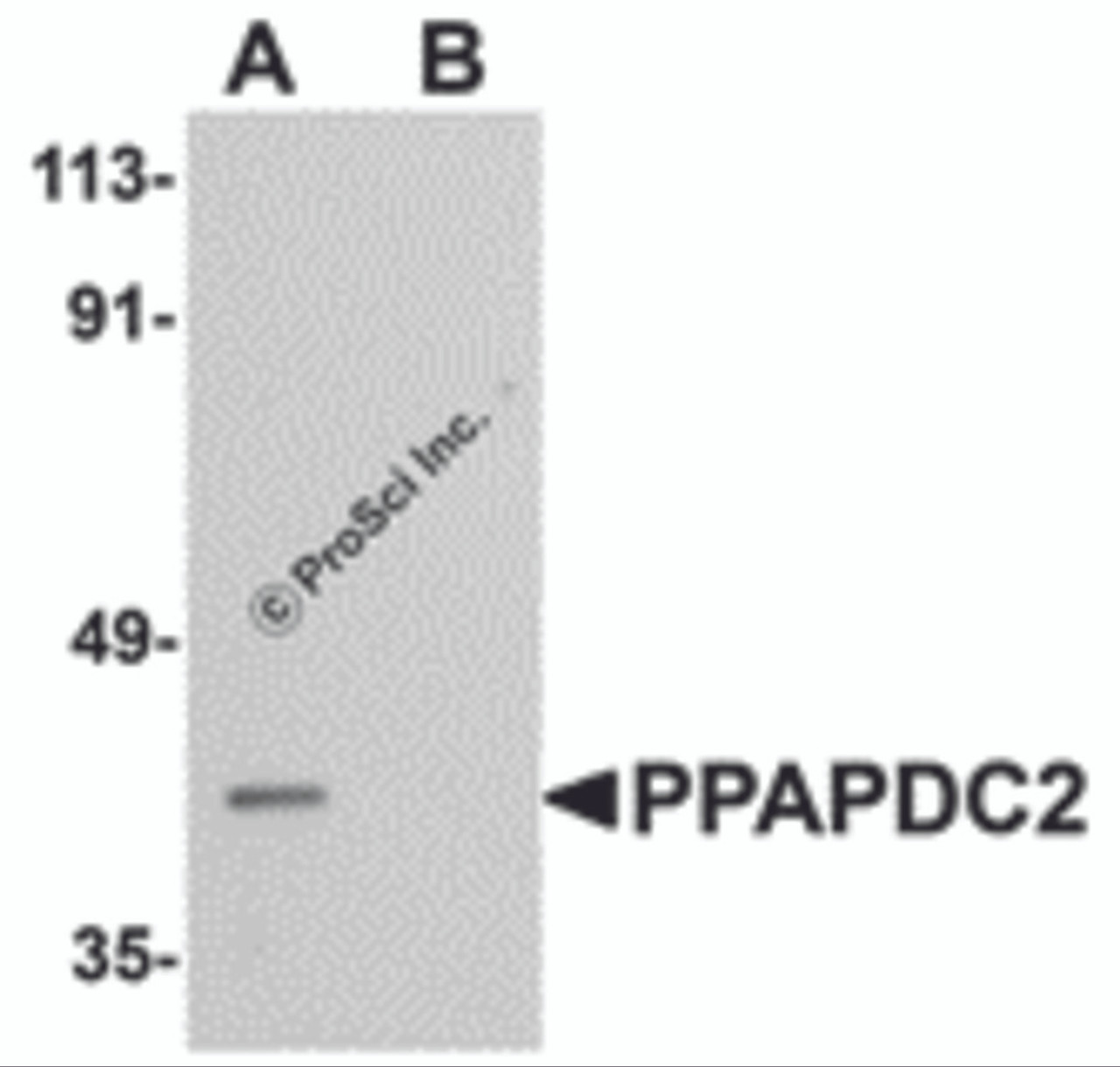 Western blot analysis of PPAPDC2 in Raji cell lysate with PPAPDC2 antibody at 1 &#956;g/mL in (A) the absence and (B) the presence of blocking peptide.
