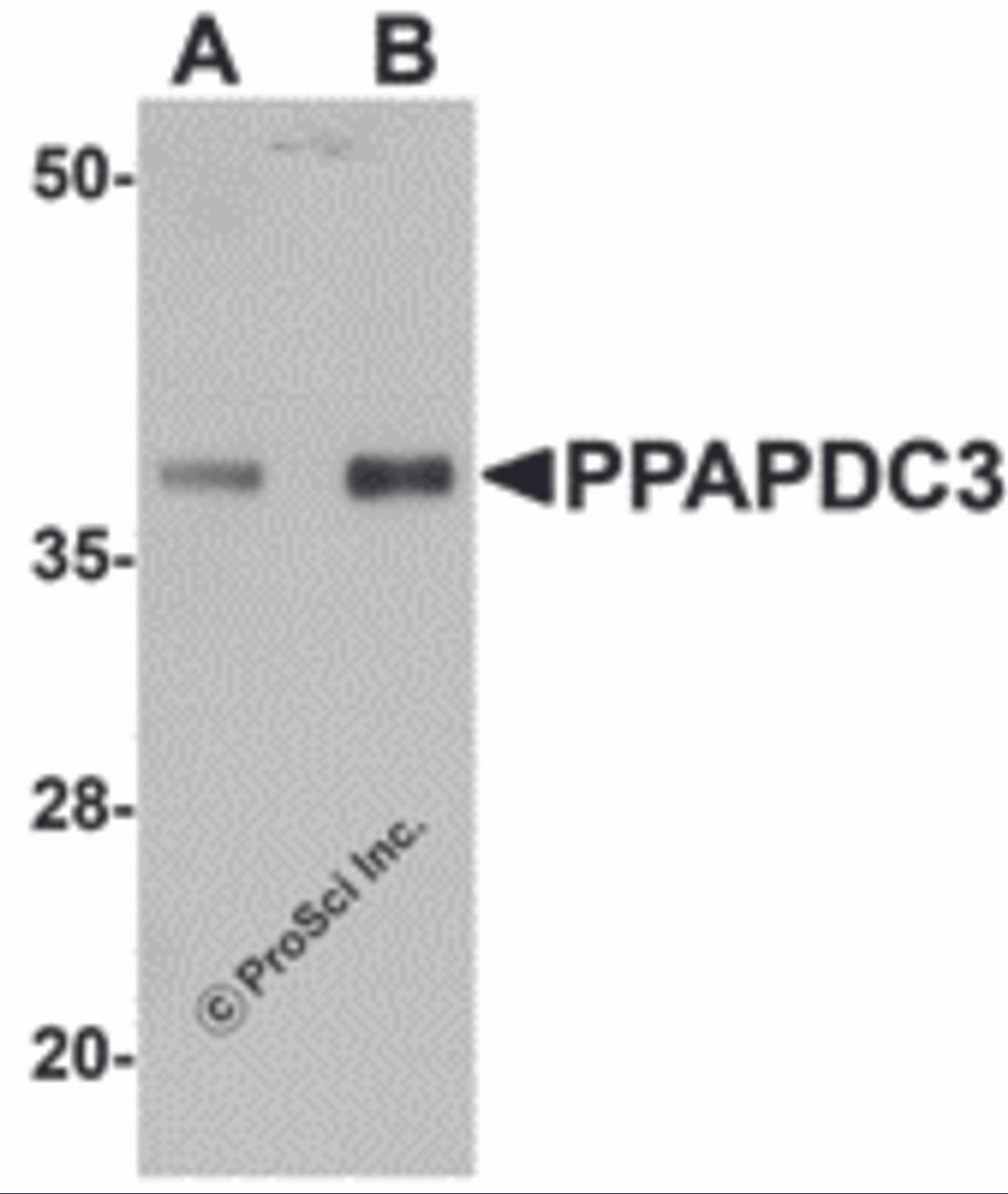 Western blot analysis of PPAPDC3 in mouse heart tissue lysate with PPAPDC3 antibody at (A) 1 and (B) 2 &#956;g/mL.