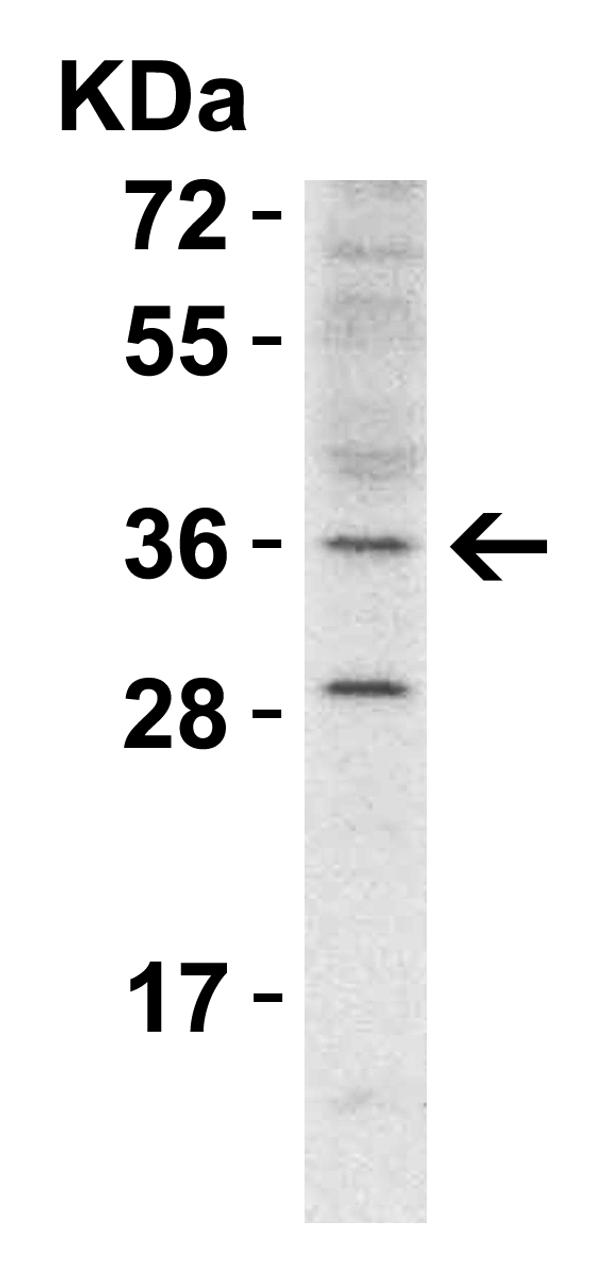 WB Validation in Mouse Heart 
Loading: 15 ug of lysate 
Antibodies: RHBDD1, 5525 1 ug/ml, 1 h incubation at RT in 5% NFDM/TBST.
Secondary: Goat Anti-Rabbit IgG HRP conjugate at 1:10000 dilution.
Exposure: 5 min