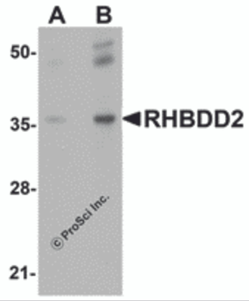 Western blot analysis of RHBDD2 in rat lung tissue lysate with RHBDD2 antibody at (A) 1 and (B) 2 &#956;g/mL.