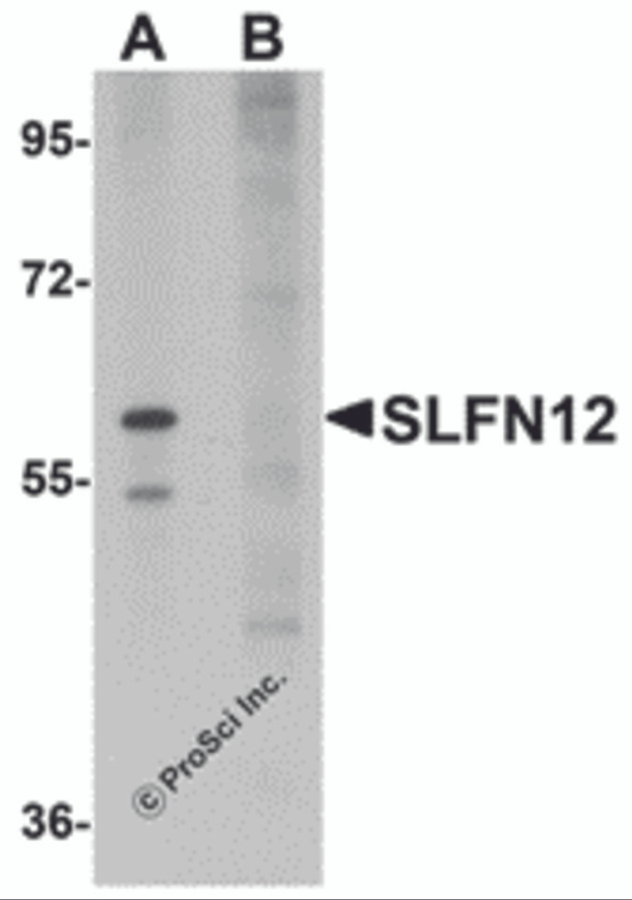 Western blot analysis of SLFN12 in SK-N-SH cell lysate with SLFN12 antibody at 1 &#956;g/mL in (A) the absence and (B) the presence of blocking peptide.