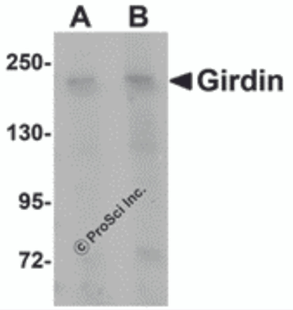 Western blot analysis of Girdin in rat brain tissue lysate with Girdin antibody at (A) 1 and (B) 2 &#956;g/mL.