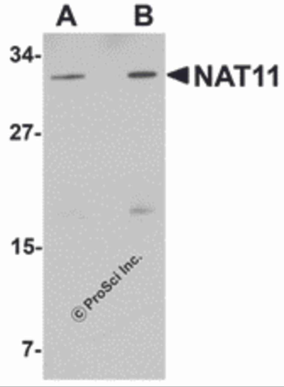 Western blot analysis of NAT11 in human thymus tissue lysate with NAT11 antibody at (A) 1 and (B) 2 &#956;g/mL.