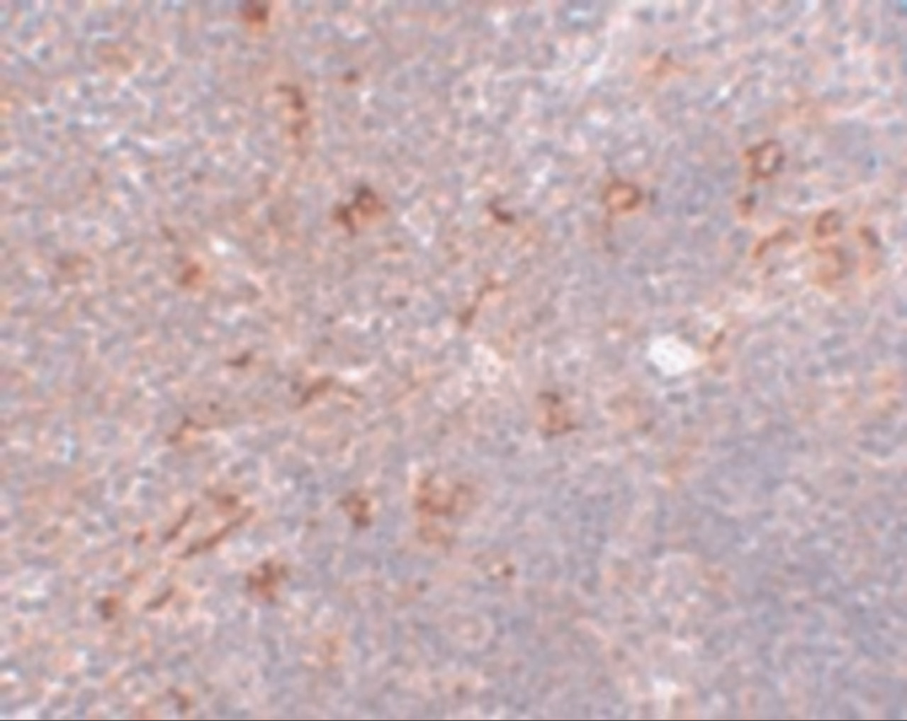 Immunohistochemistry of NAT11 in mouse thymus tissue with NAT11 antibody at 5 ug/mL.