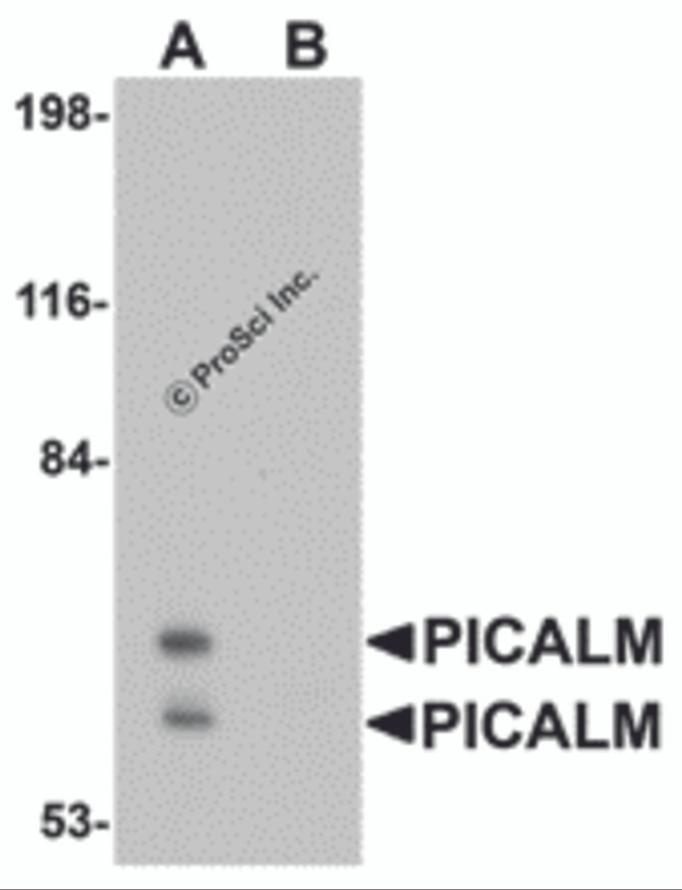 Western blot analysis of PICALM in EL4 cell lysate with PICALM antibody at 1 &#956;g/mL in (A) the absence and (B) the presence of blocking peptide.