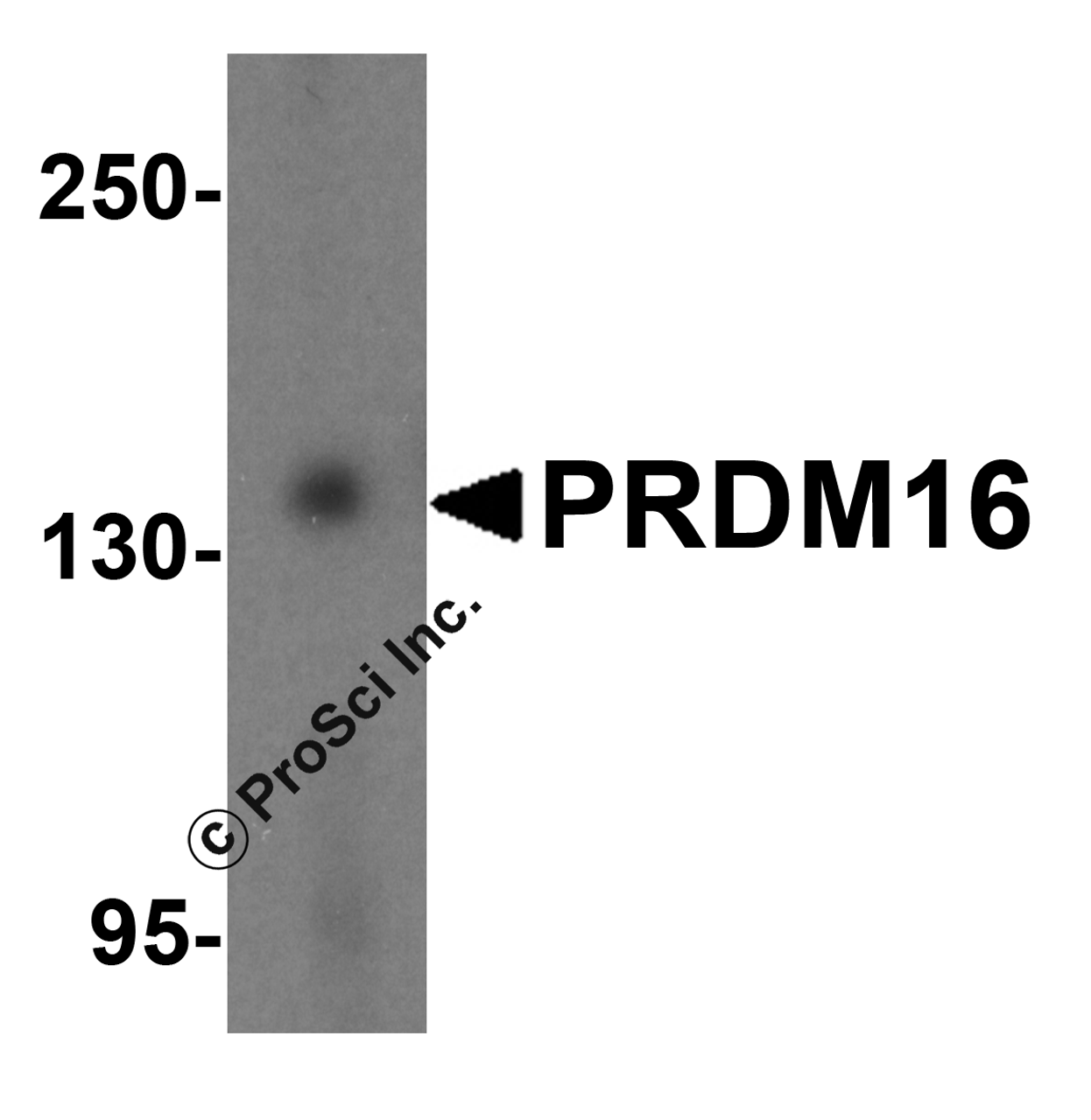 Western blot analysis of PRDM16 in K562 cell lysate with PRDM16 antibody at 1 &#956;g/mL.