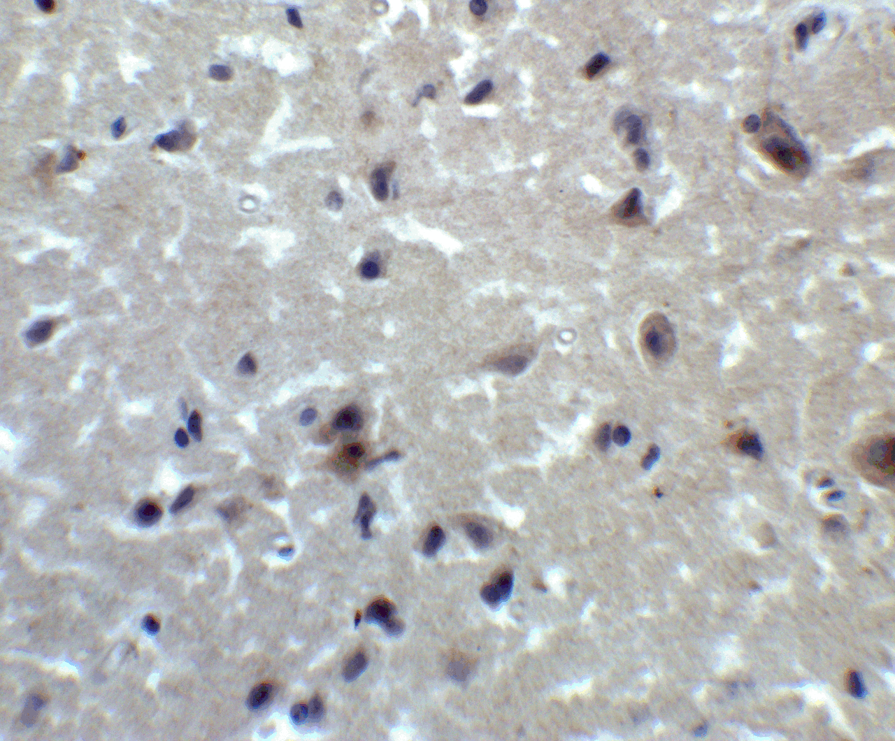 Immunohistochemistry of PRDM16 in human brain tissue with PRDM16 antibody at 2 ug/ml.