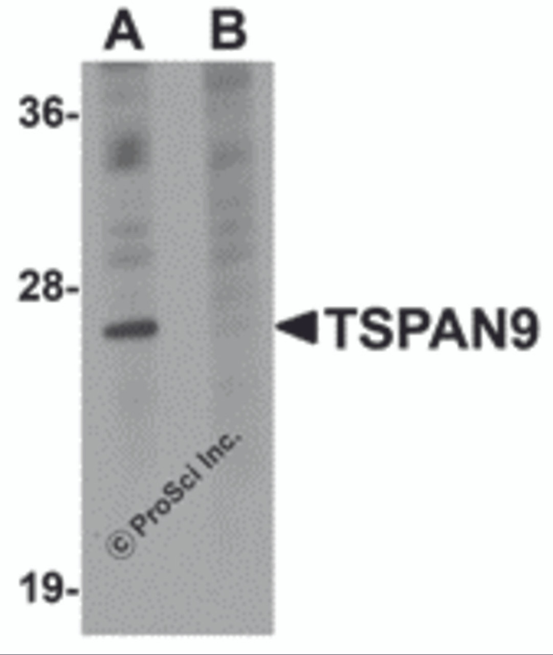 Western blot analysis of TSPAN9 in EL4 cell lysate with TSPAN9 antibody at 1 &#956;g/mL in (A) the absence and (B) the presence of blocking peptide.