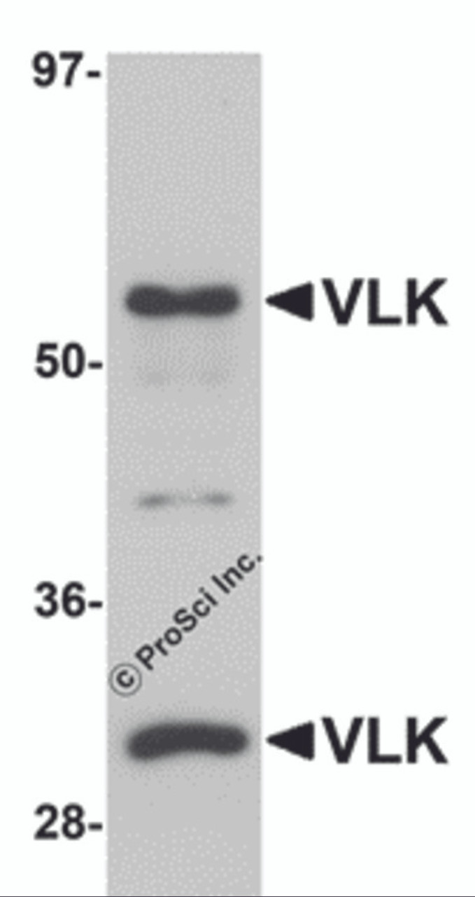 Western blot analysis of VLK in human lung tissue lysate with VLK antibody at 1 &#956;g/mL.