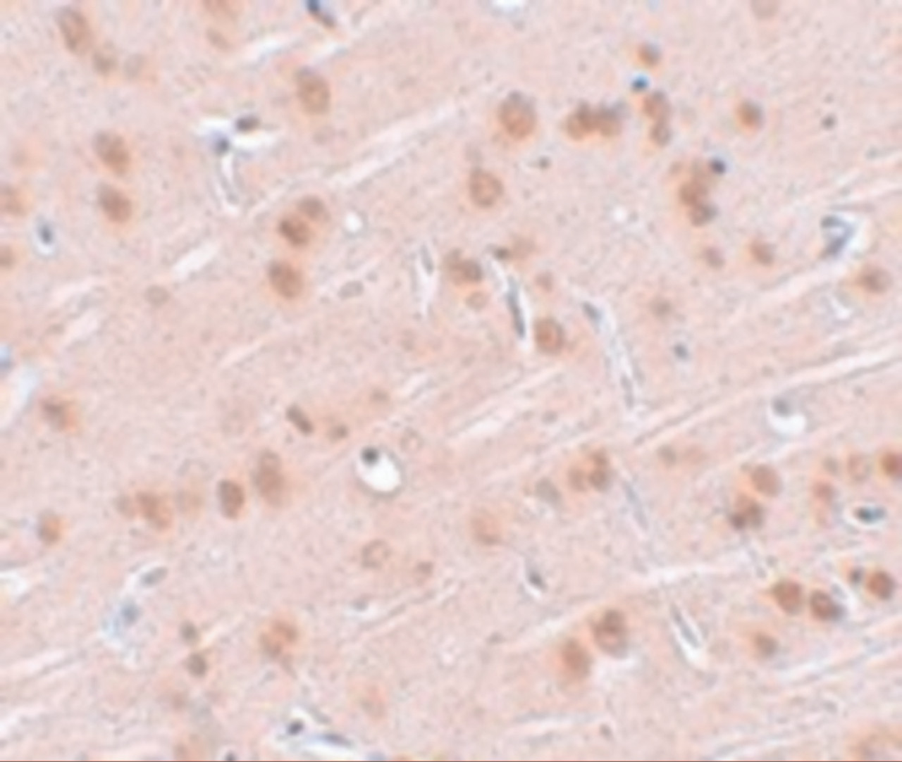 Immunohistochemistry of SYNGR1 in rat brain tissue with SYNGR1 antibody at 2.5 ug/mL.