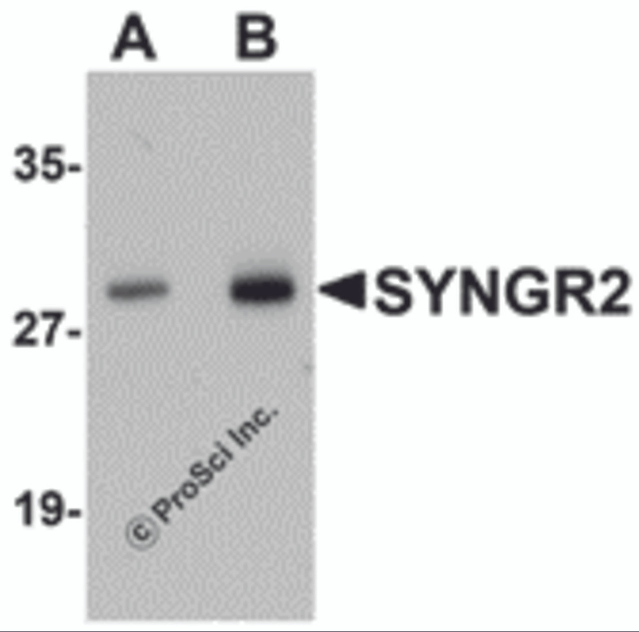 Western blot analysis of SYNGR2 in human lung tissue lysate with SYNGR2 antibody at (A) 1 and (B) 2 &#956;g/mL.