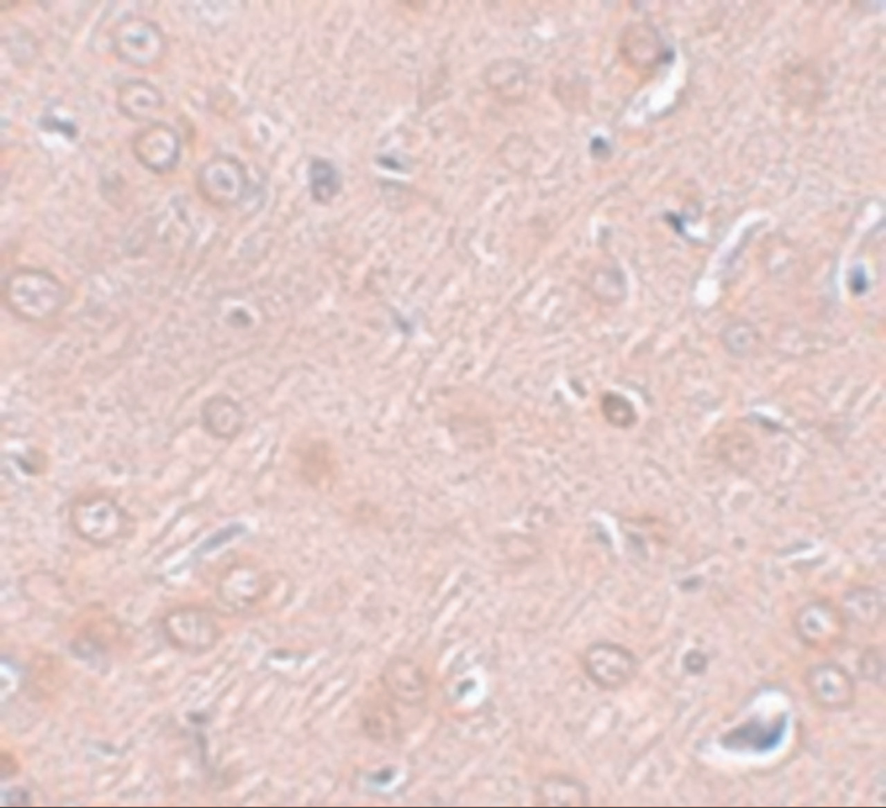 Immunohistochemistry of SYNGR2 in rat brain tissue with SYNGR2 antibody at 2.5 ug/mL.
