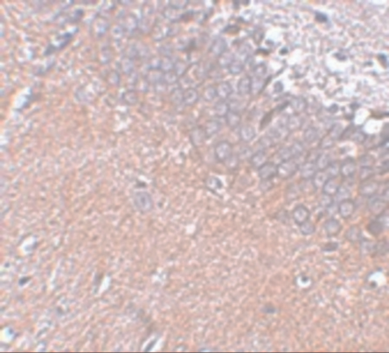 Immunohistochemistry of SYNGR4 in rat brain tissue with SYNGR4 antibody at 5 ug/mL.