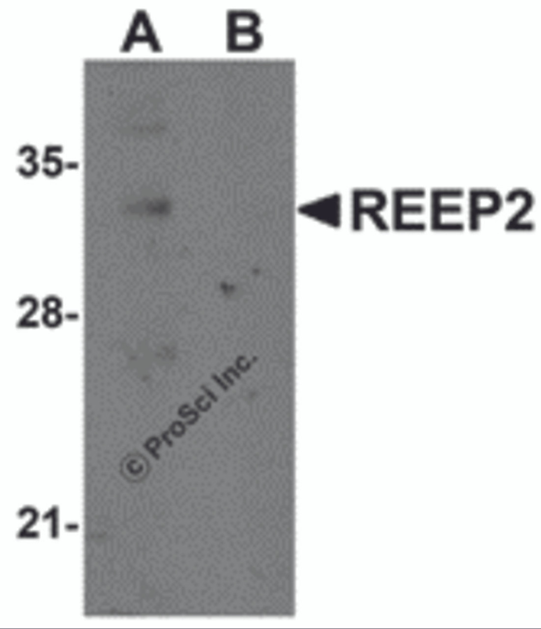 Western blot analysis of REEP2 in mouse lung tissue lysate with REEP2 antibody at 1 &#956;g/mL in (A) the absence and (B) the presence of blocking peptide.