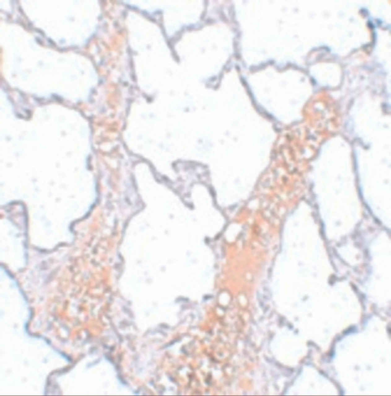 Immunohistochemistry of REEP2 in rat lung tissue with REEP2 antibody at 5 ug/mL.