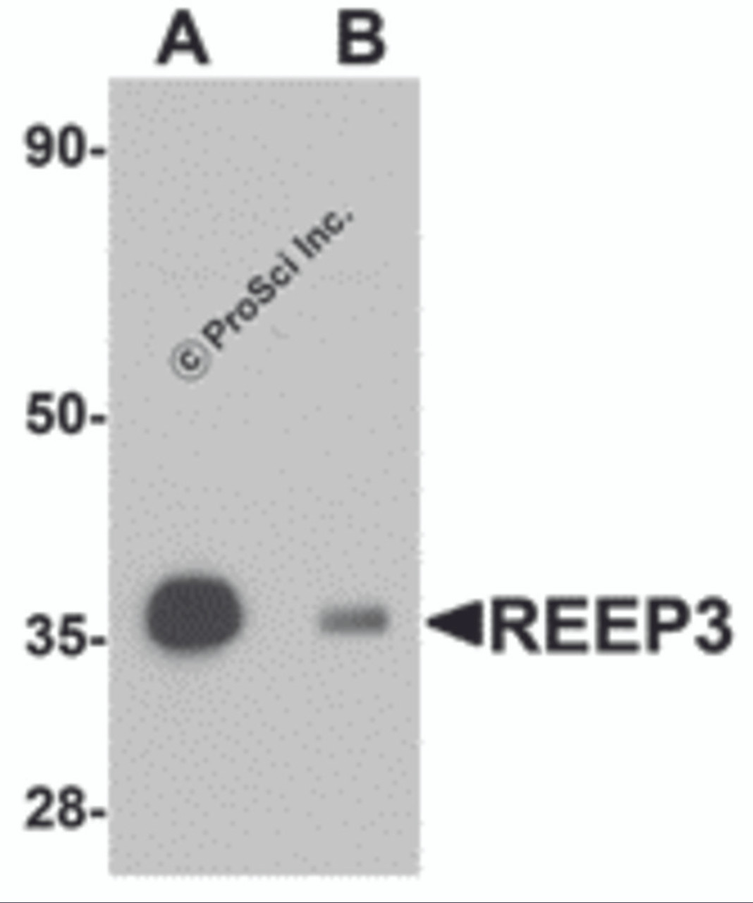 Western blot analysis of REEP3 in rat heart tissue lysate with REEP3 antibody at 1 &#956;g/mL in (A) the absence and (B) the presence of blocking peptide.