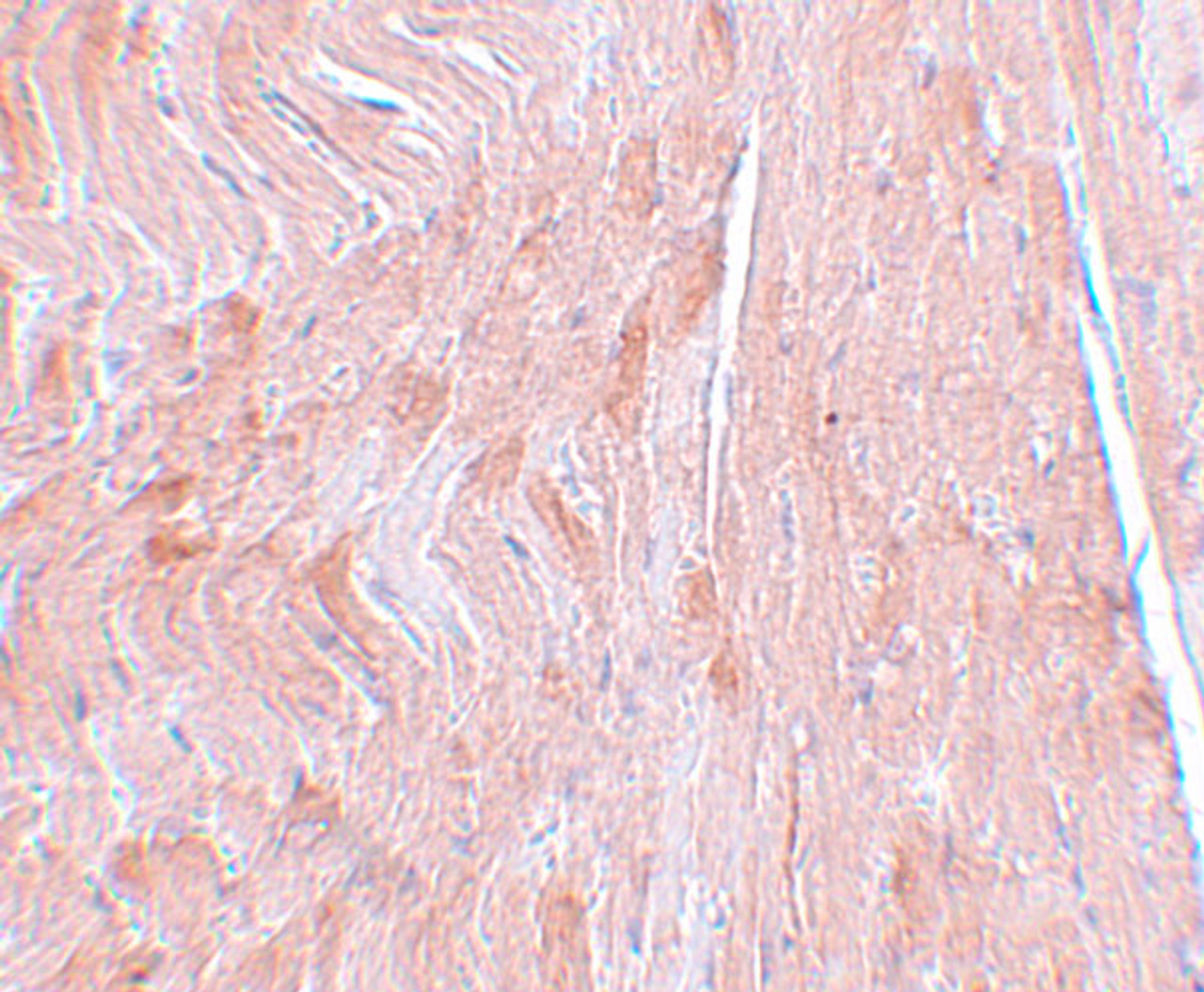 Immunohistochemistry of REEP3 in mouse heart tissue with REEP3 antibody at 5 ug/mL.