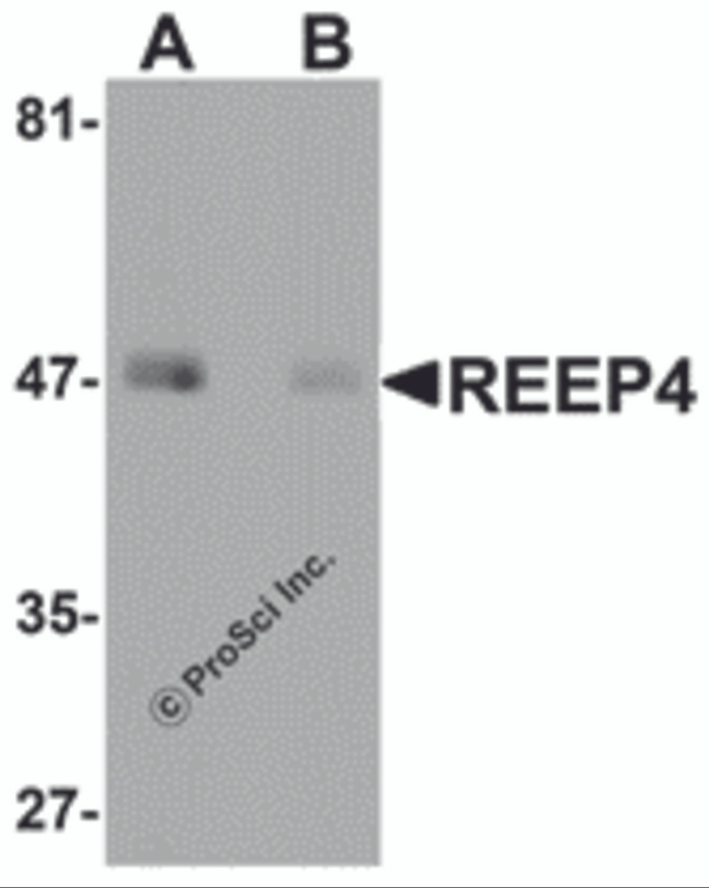 Western blot analysis of REEP4 in human lung tissue lysate with REEP4 antibody at 1 &#956;g/ml in (A) the absence and (B) the presence of blocking peptide.