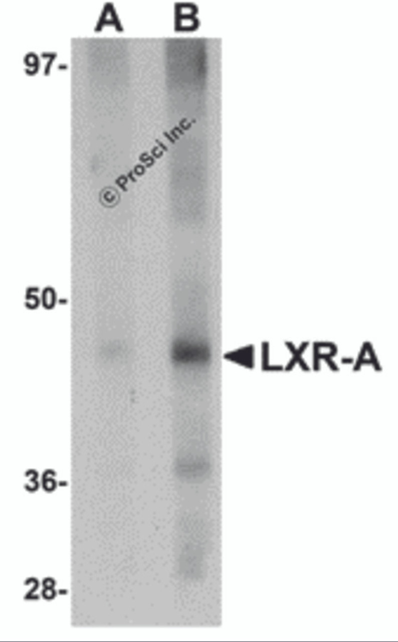 Western blot analysis of LXR-A in rat liver tissue lysate with LXR-A antibody at (A) 1 and (B) 2 &#956;g/mL.
