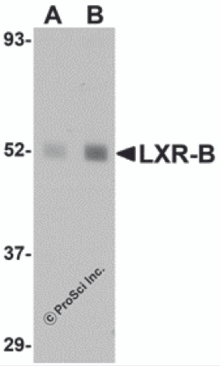 Western blot analysis of LXR-B in human lung tissue lysate with LXR-B antibody at (A) 1 and (B) 2 &#956;g/mL.