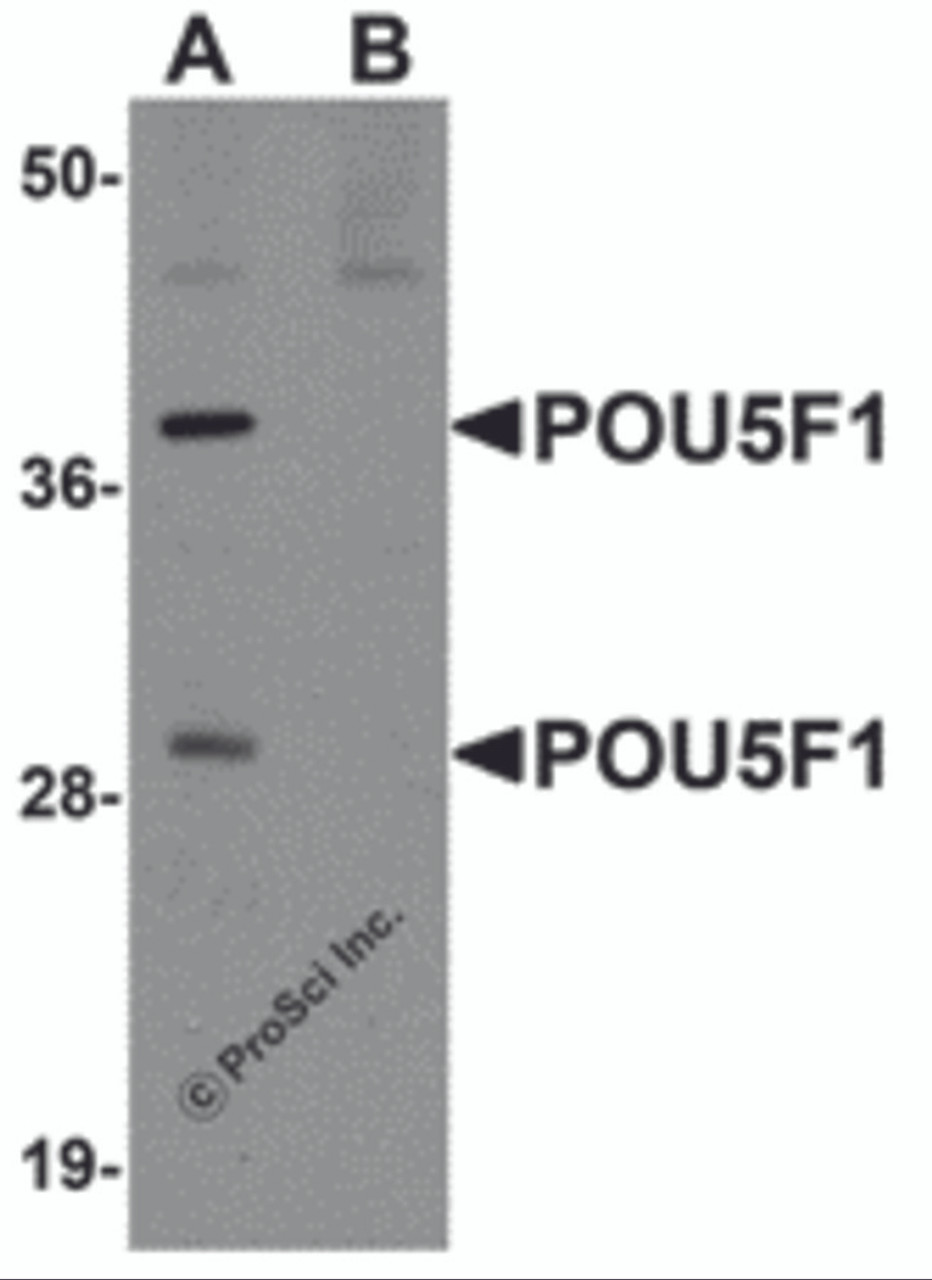 Western blot analysis of POU5F1 in mouse liver tissue lysate with POU5F1 antibody at 1 &#956;g/ml in (A) the absence and (B) the presence of blocking peptide.