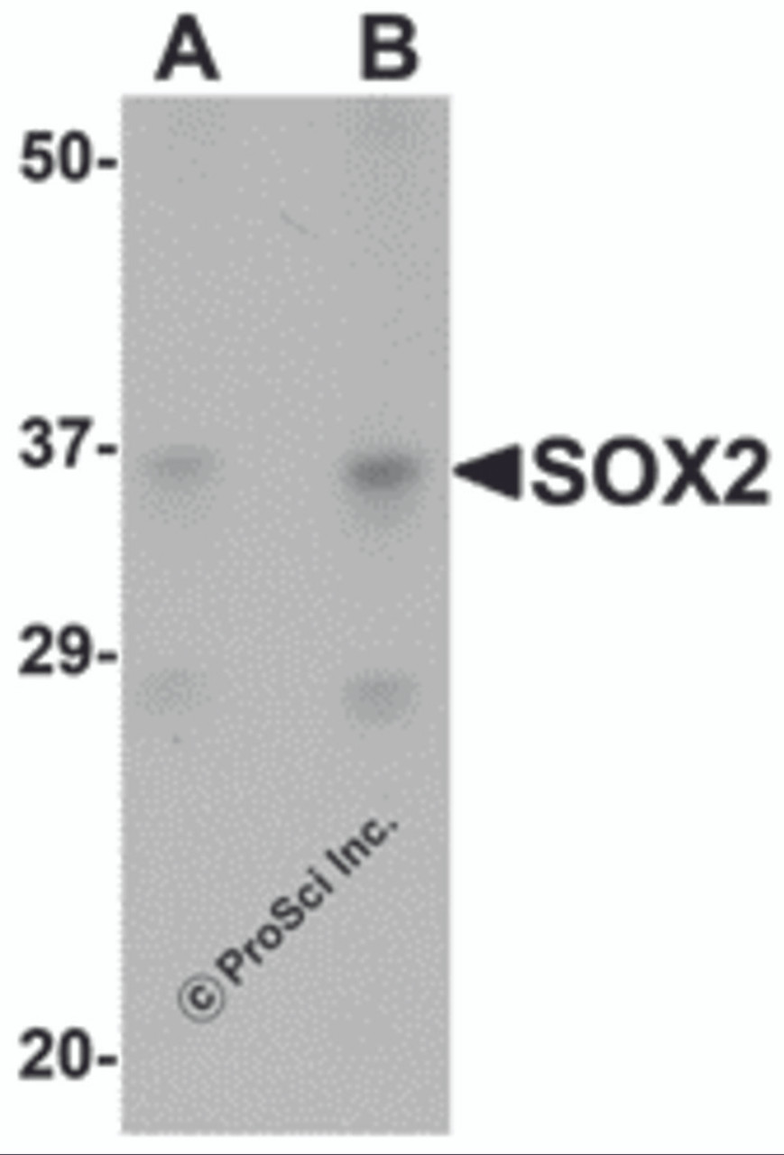 Western blot analysis of SOX2 in 3T3 cell lysate with SOX2 antibody at (A) 1 and (B) 2 &#956;g/mL.