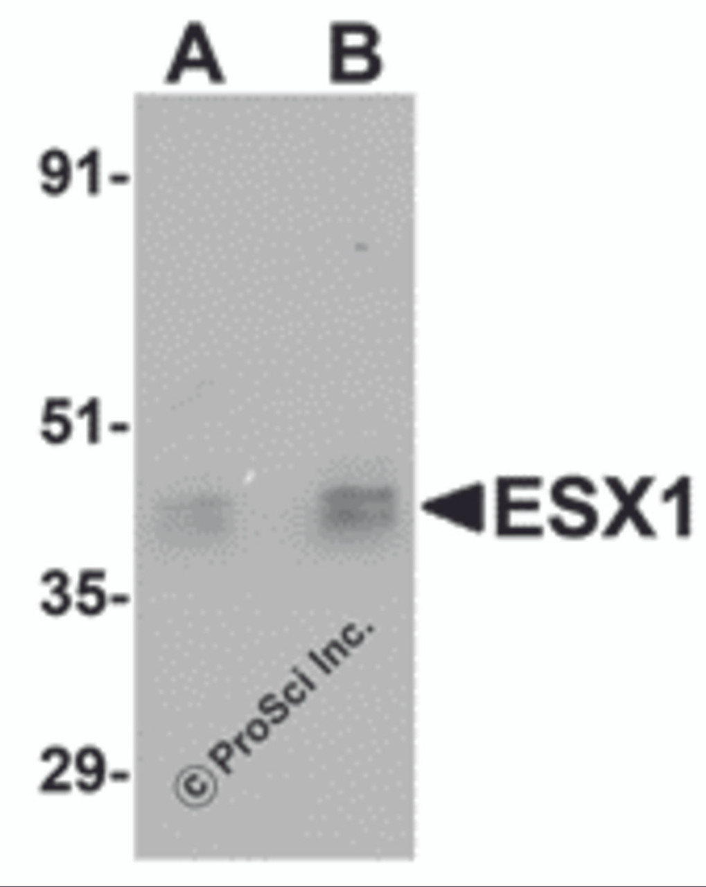 Western blot analysis of ESX1 in human testis tissue lysate with ESX1 antibody at (A) 1 and (B) 2 &#956;g/mL.