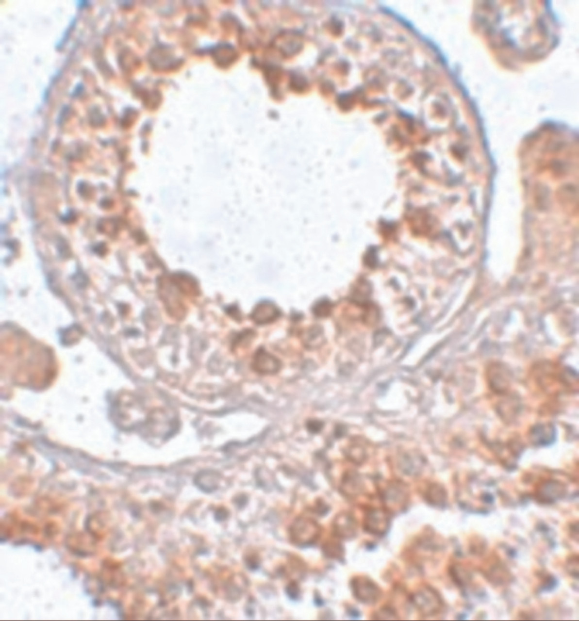 Immunohistochemistry of ESX1 in human testis tissue with ESX1 antibody at 2.5 ug/mL.