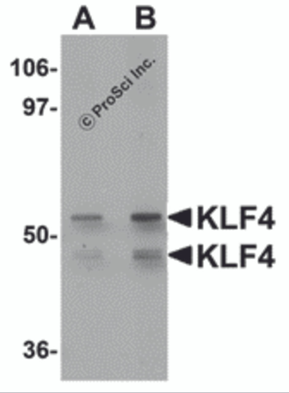 Western blot analysis of KLF4 in human liver tissue lysate with KLF4 antibody at (A) 1 and (B) 2 &#956;g/mL.