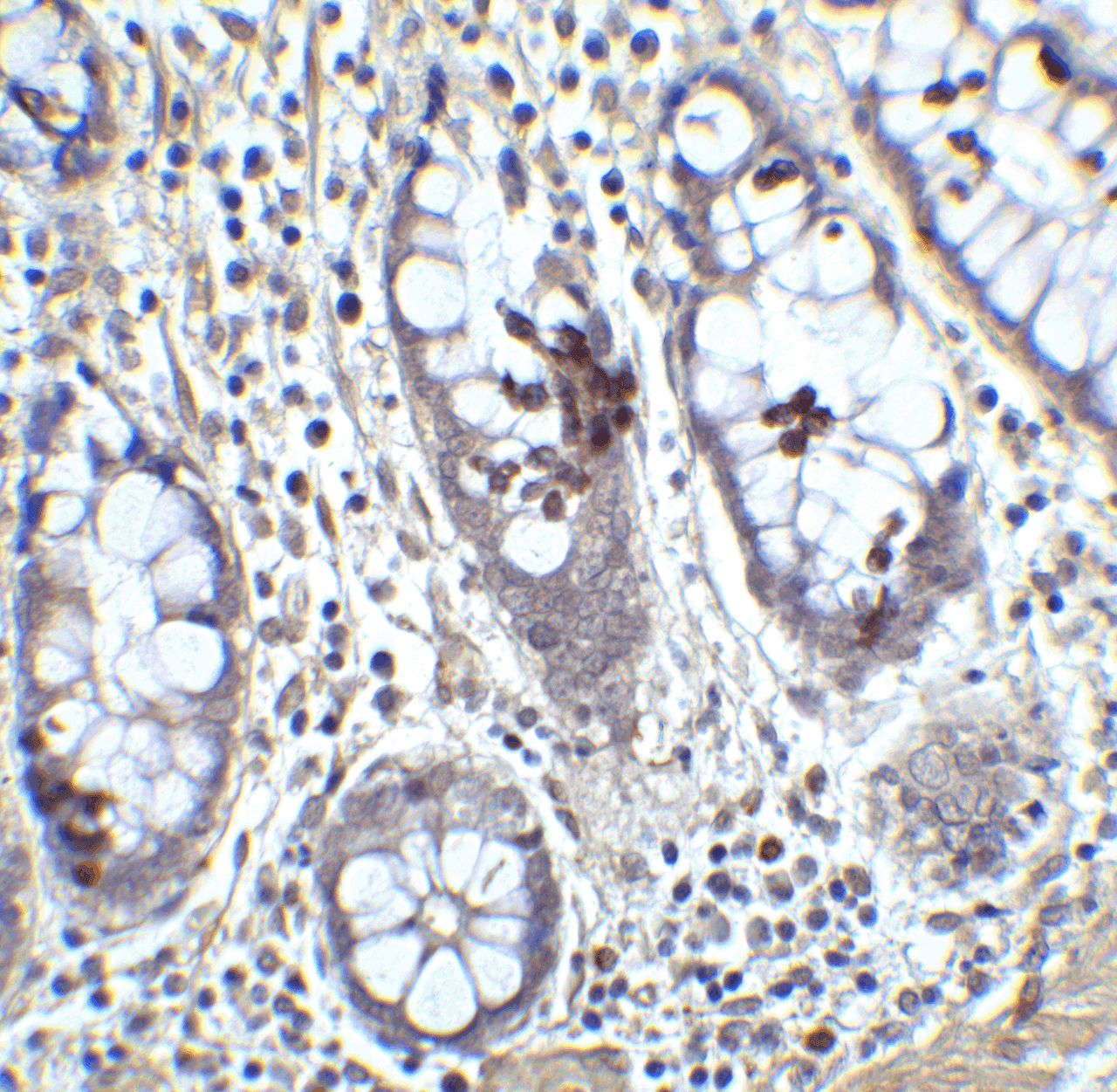 Immunohistochemistry of KLF4 in human colon tissue with KLF4 antibody at 5 ug/mL.