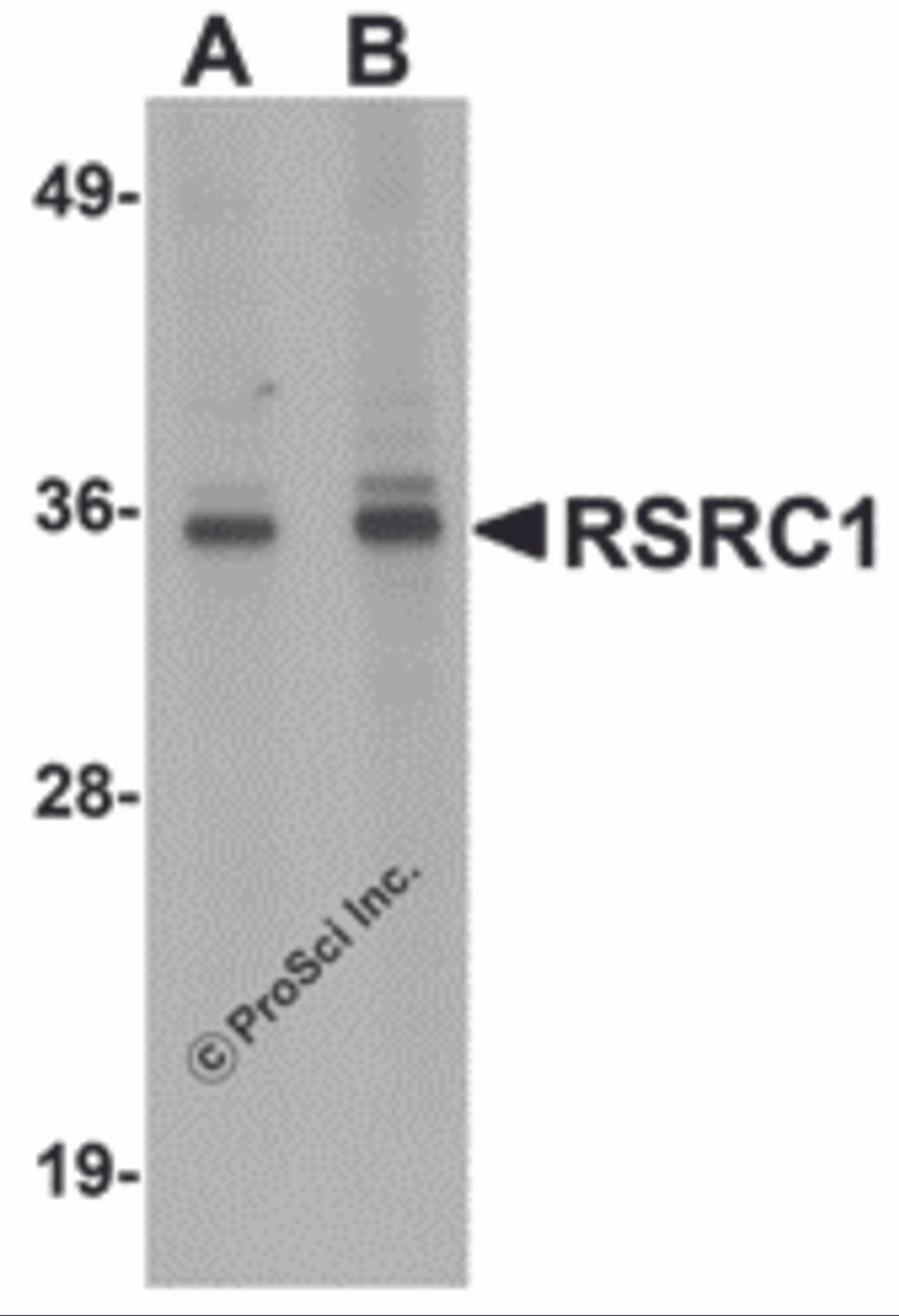 Western blot analysis of RSRC1 in HepG2 cell lysate with RSRC1 antibody at (A) 1 and (B) 2 &#956;g/mL.