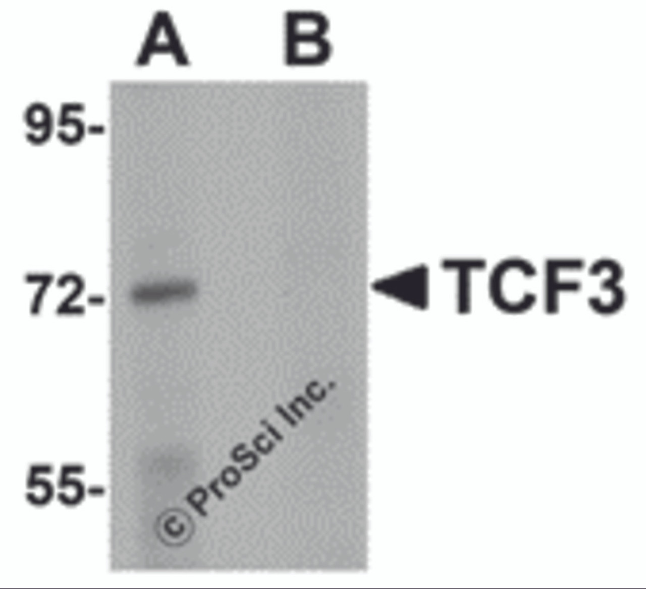 Western blot analysis of TCF3 in Human brain tissue lysate with TCF3 antibody at 1 &#956;g/mL in (A) the absence and (B) presence of peptide blocking.