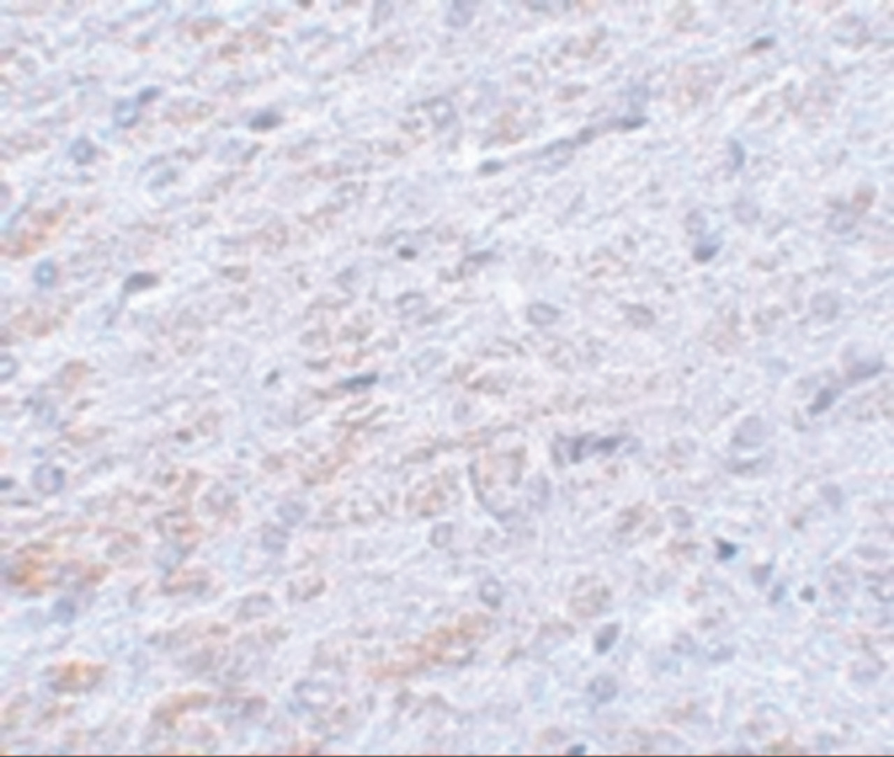 Immunohistochemistry of TCF3 in rat liver tissue with TCF3 antibody at 5 ug/mL.