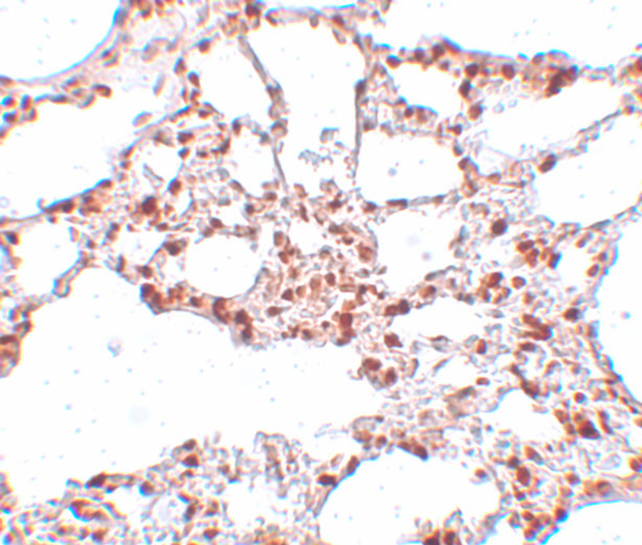 Immunohistochemistry of ZSCAN4 in rat lung tissue with ZSCAN4 antibody at 5 ug/mL.