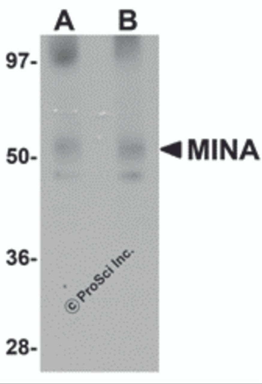 Western blot analysis of MINA in human heart tissue lysate with MINA antibody at (A) 1 and (B) 2 &#956;g/mL.