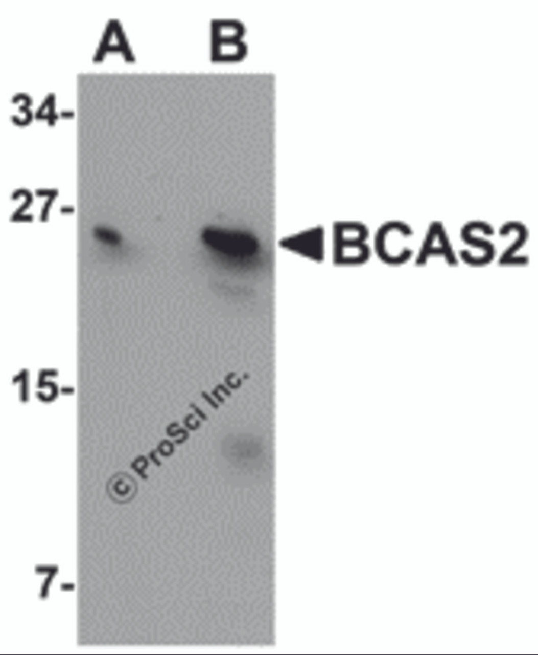 Western blot analysis of BCAS2 in MCF7 cell lysate with BCAS2 antibody at (A) 0.5 and (B) 1 &#956;g/mL.