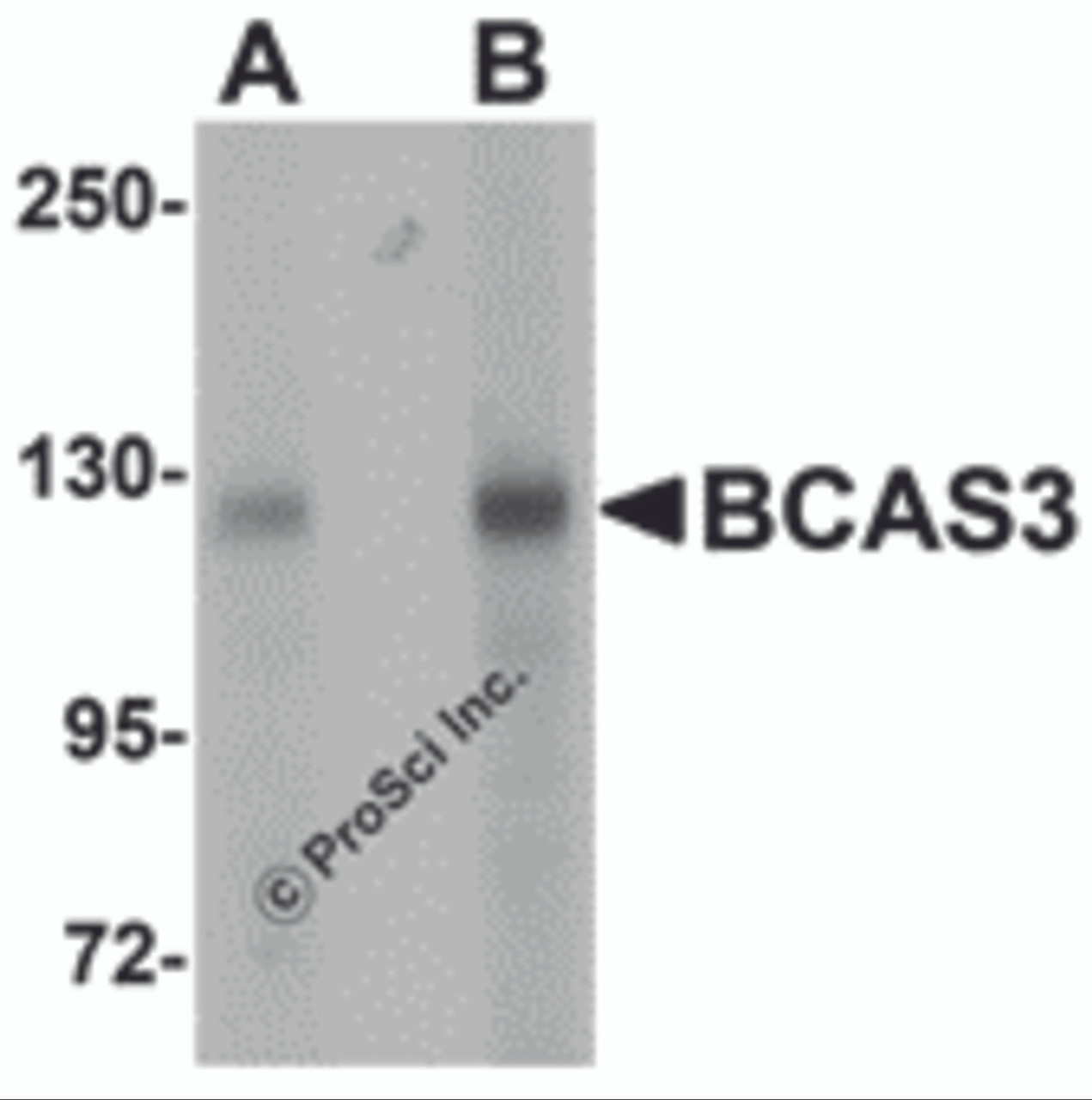 Western blot analysis of BCAS3 in rat brain tissue lysate with BCAS3 antibody at (A) 0.5 and (B) 1 &#956;g/mL.