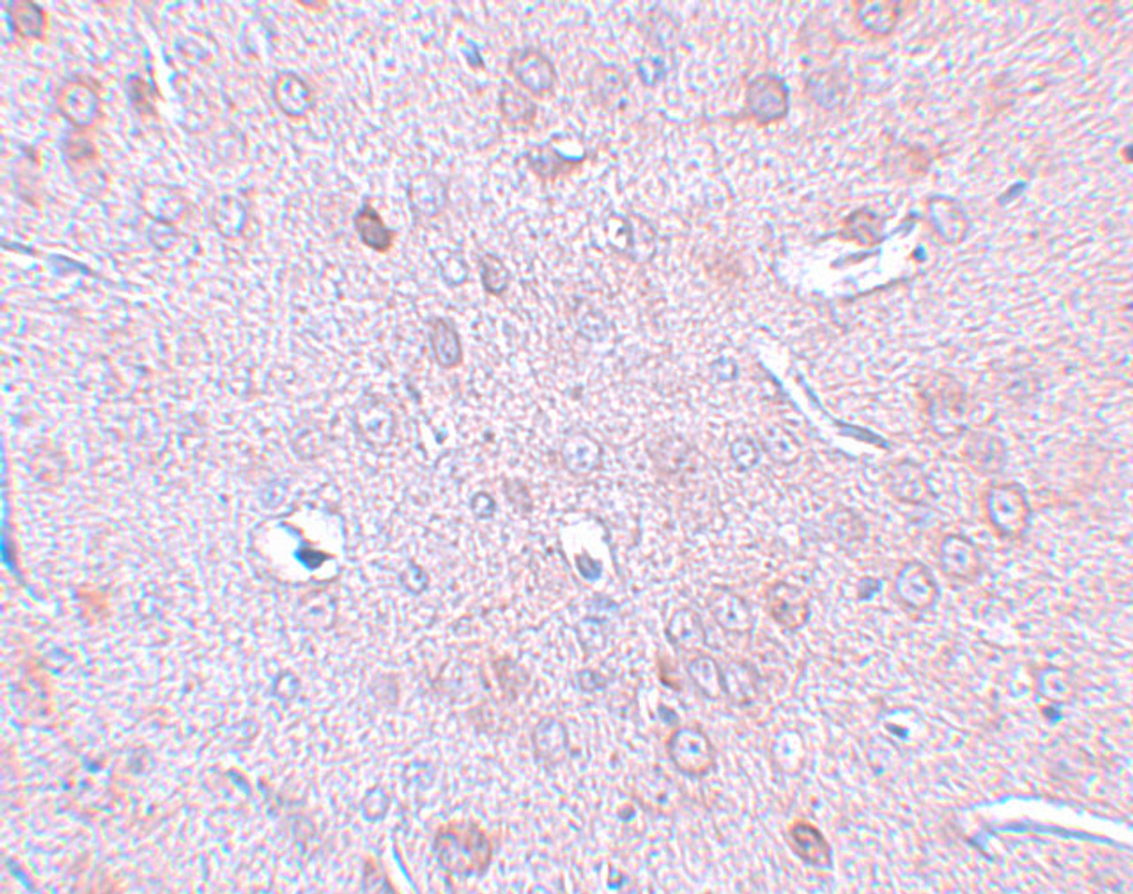 Immunohistochemistry of DLCK1 in rat brain tissue with DLCK1 antibody at 2.5 ug/mL.