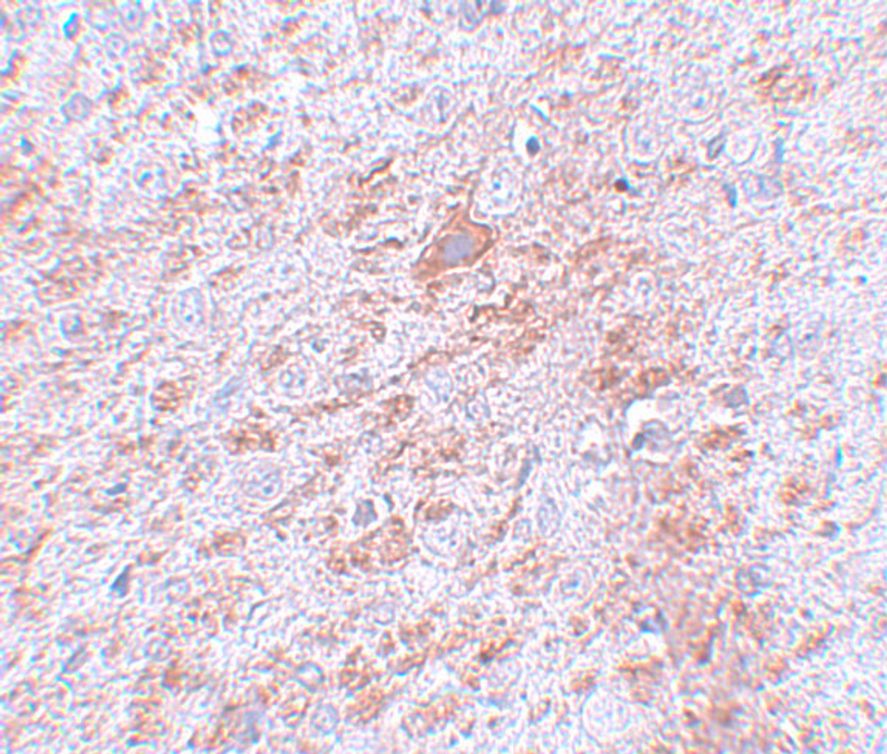 Immunohistochemistry of DLCK2 in rat brain tissue with DLCK2 antibody at 5 ug/mL.