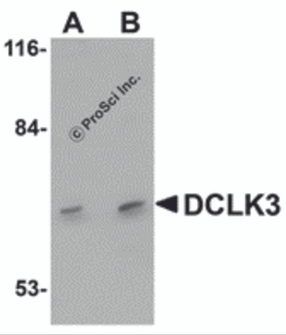 Western blot analysis of DCLK3 in K562 cell lysate with DCLK3 antibody at (A) 1 and (B) 2 &#956;g/mL.