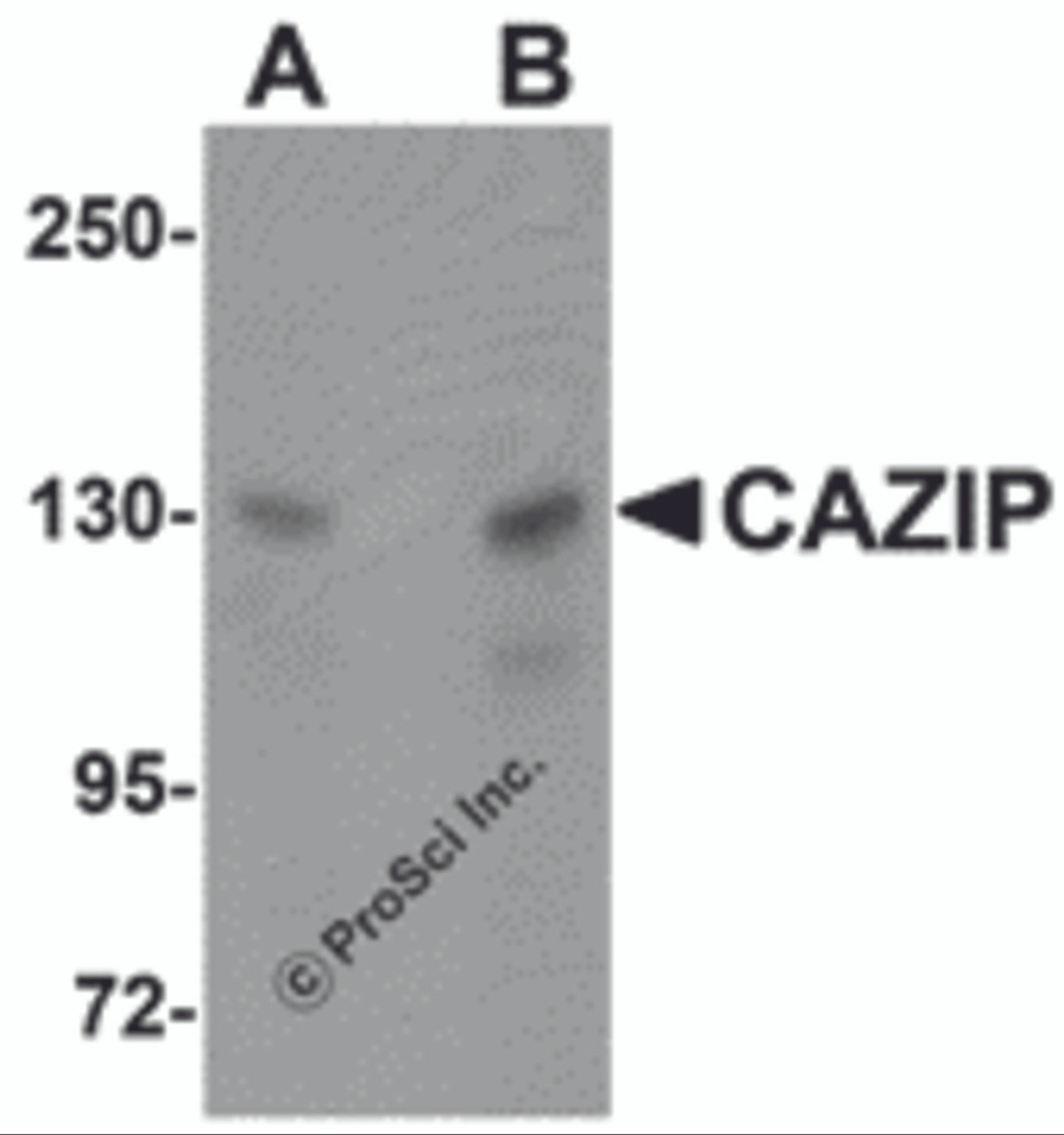 Western blot analysis of CAZIP in A20 cell lysate with CAZIP antibody at (A) 0.5 and (B) 1 &#956;g/mL.