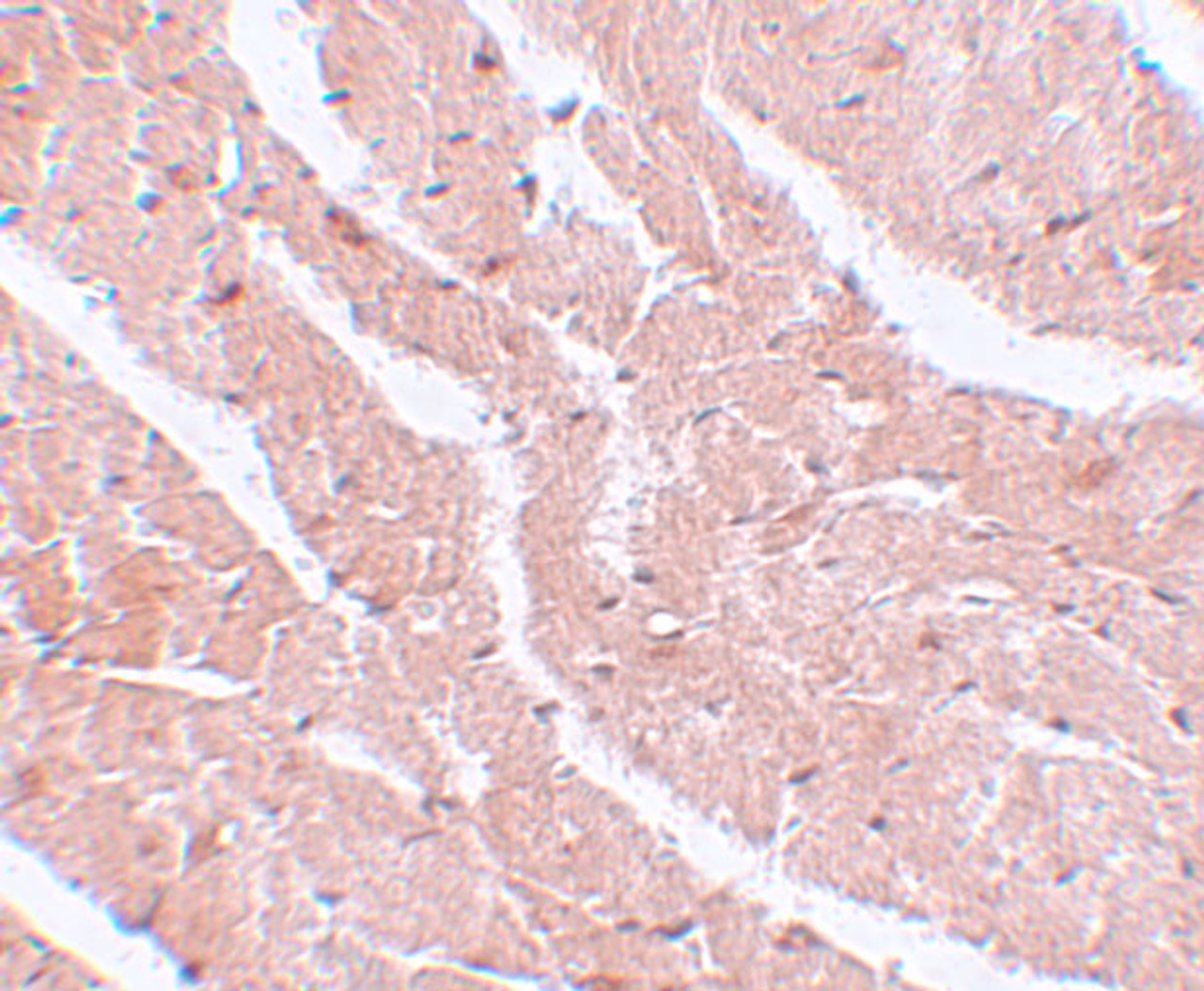 Immunohistochemistry of CAZIP in mouse heart tissue with CAZIP antibody at 5 ug/mL.