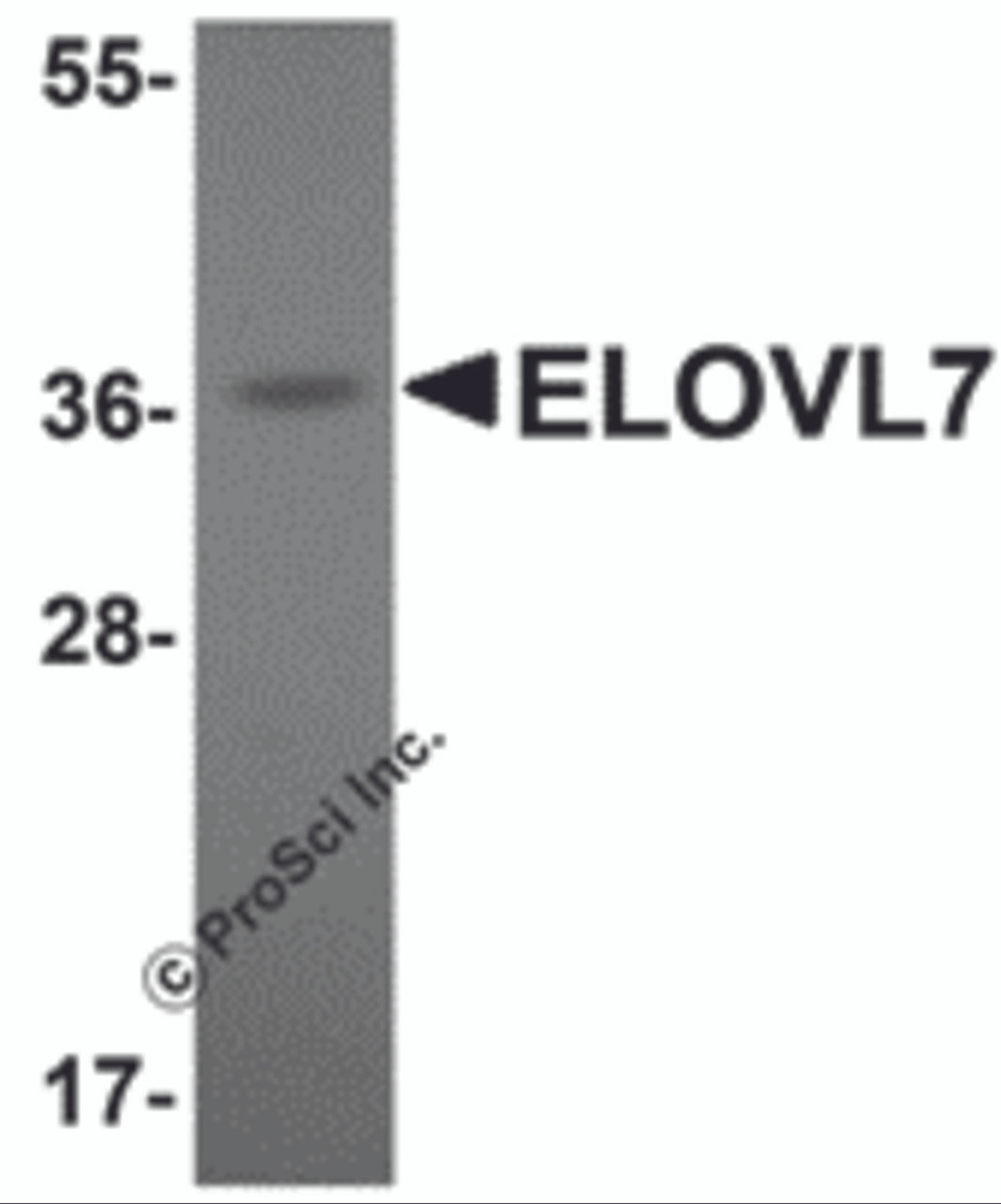 Western blot analysis of ELOVL7 in human liver tissue lysate with ELOVL7 antibody at 1 &#956;g/mL.